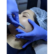woman receiving dermaplaning facial treatment
